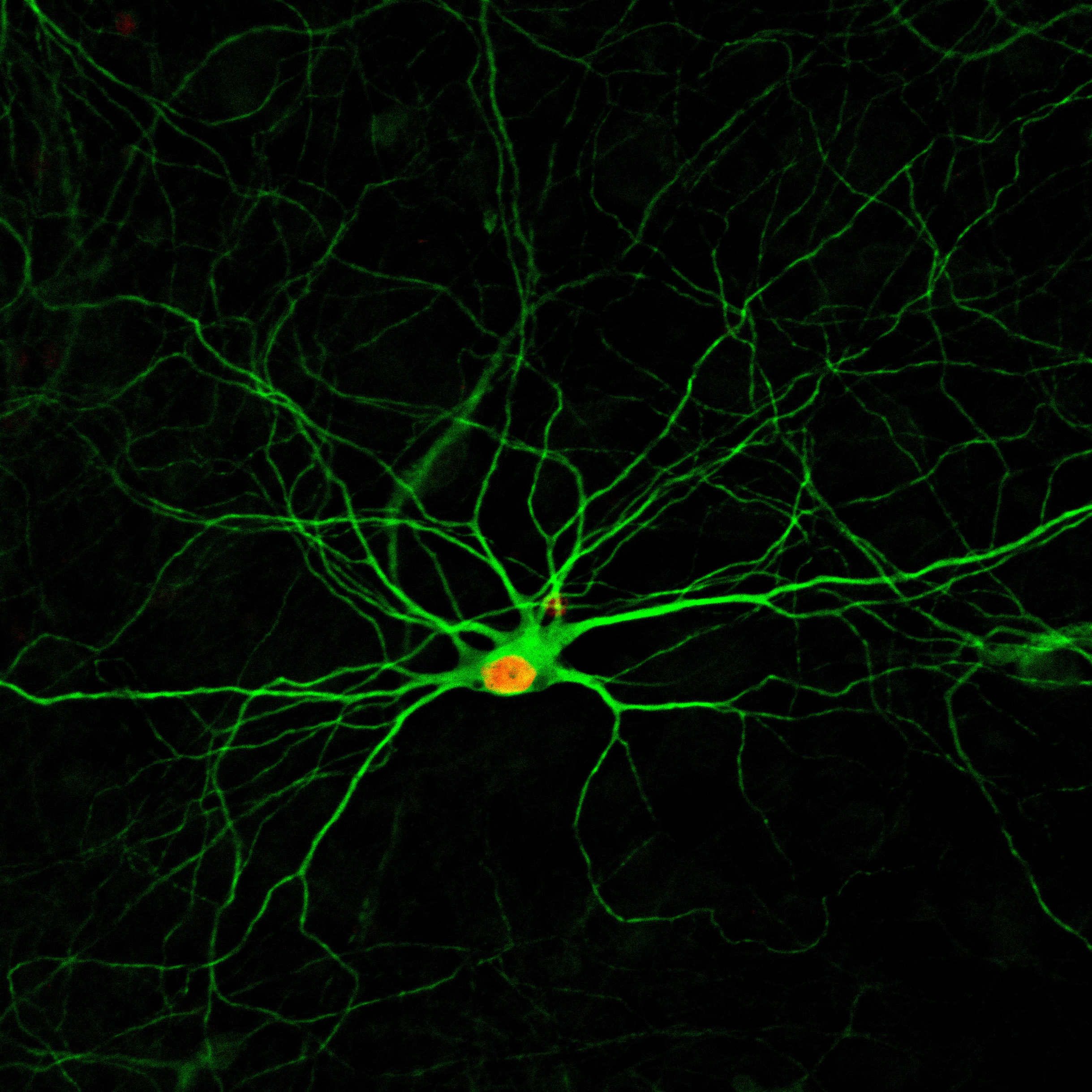 Neuroscience